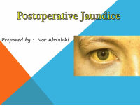 Postoperative - Jaundice.pptx